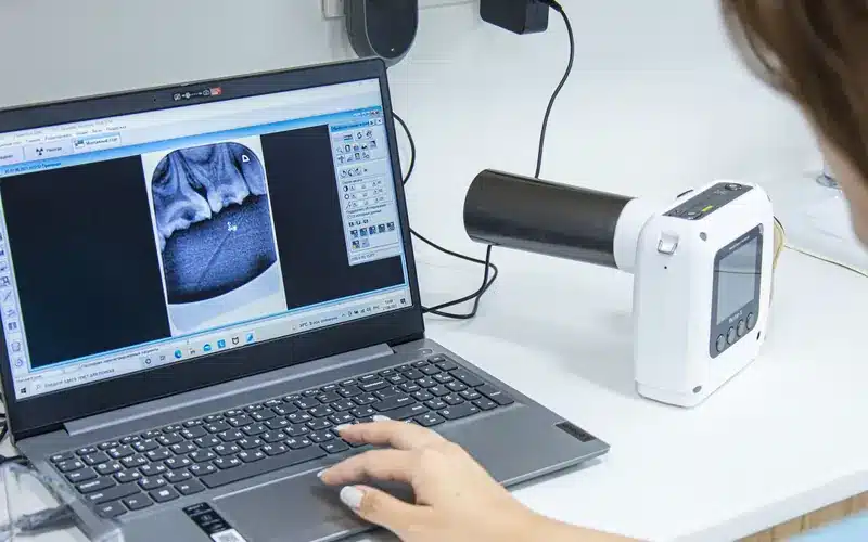 Medical professional reviewing a dental X-ray on a clinic laptop
